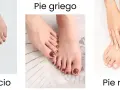 Tres tipos de pies: egipcio, griego y romano. El pie griego tiene el segundo dedo más largo que el pulgar.
