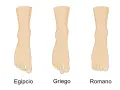 Tres tipos de pies: el pie egipcio con el dedo gordo prominente, el griego con el segundo dedo más largo, y el romano con dedos de longitud similar.