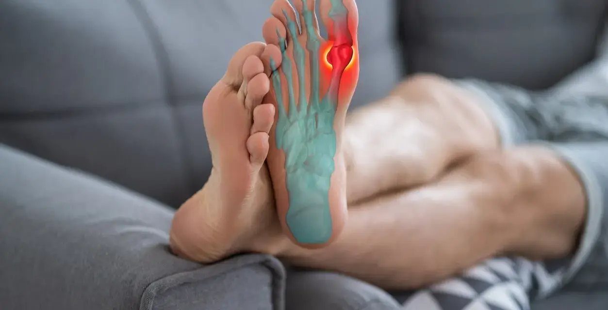 Pie con radiografía que muestra dolor lateral dedo gordo.