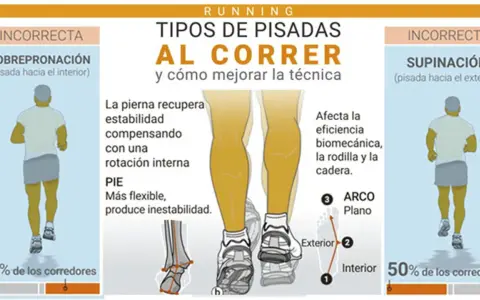Ilustración muestra tipos de pisada al correr: pronación, supinación y la ideal pisada neutra.