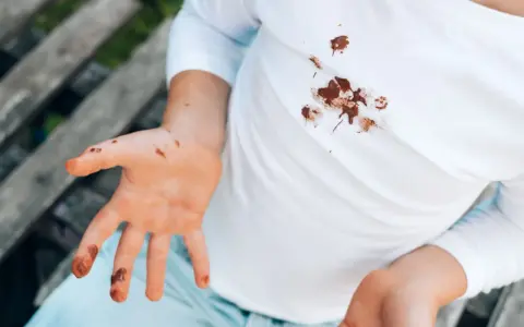 Manos y camiseta blanca con manchas de chocolate. Un niño muestra sus manos sucias y su ropa manchada, buscando cómo quitar manchas de chocolate ya lavadas.