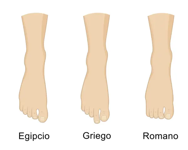 Tres tipos de pies: el pie egipcio con el dedo gordo prominente, el griego con el segundo dedo más largo, y el romano con dedos de longitud similar.