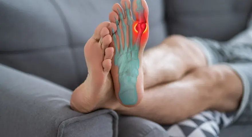 Pie con radiografía que muestra dolor lateral dedo gordo.