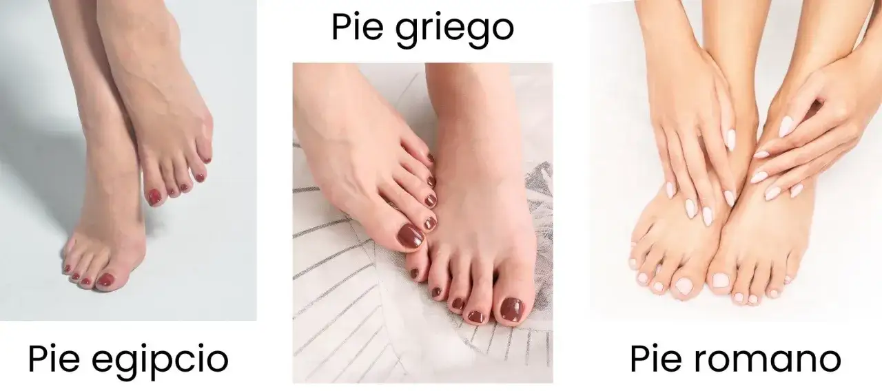 Tres tipos de pies: egipcio, griego y romano. El pie griego tiene el segundo dedo m&aacute;s largo que el pulgar.