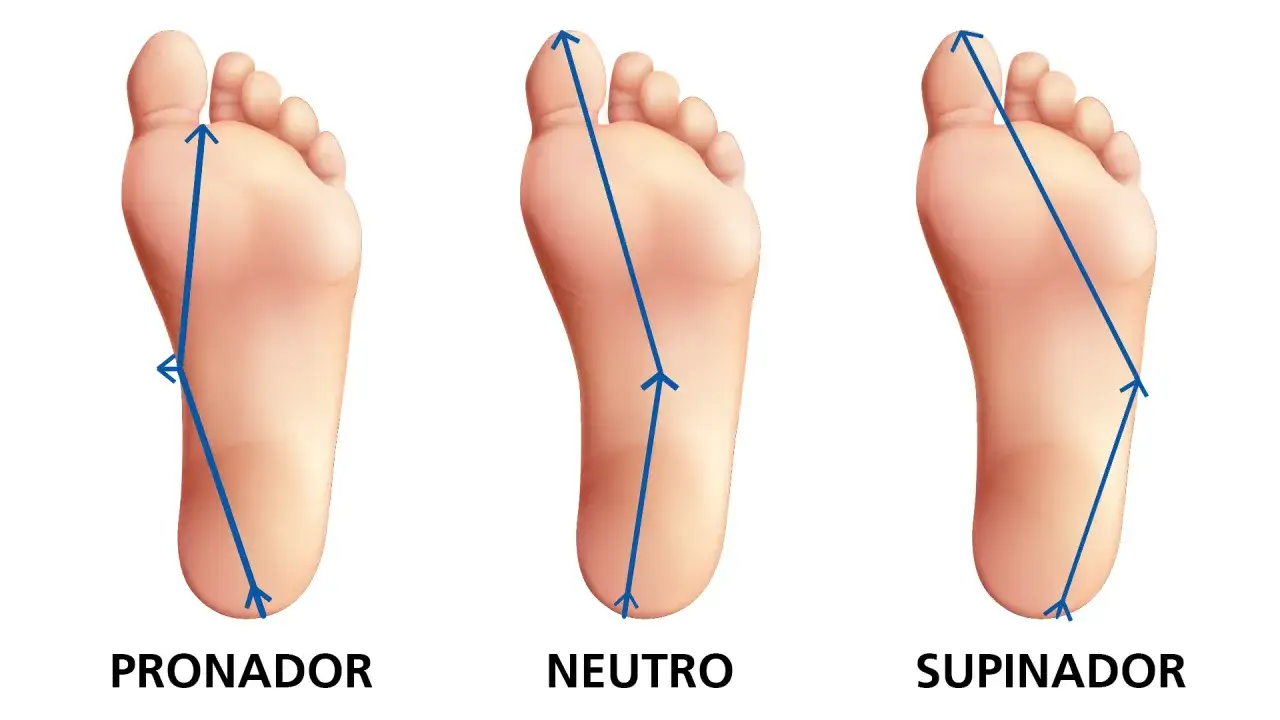 Tres tipos de pisada: pronador, neutro y supinador. La pisada pronadora muestra un desv&iacute;o hacia adentro del pie.