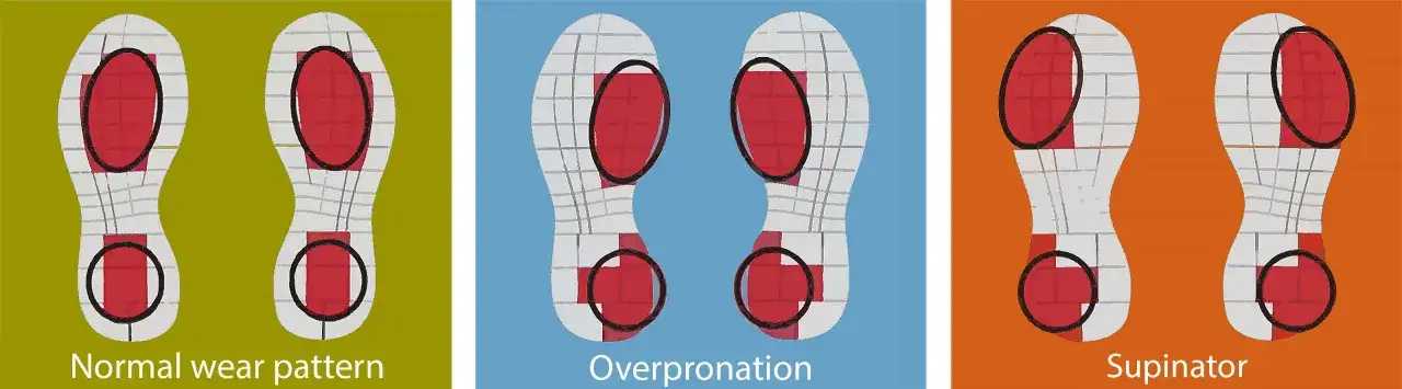 Patrones de desgaste de zapatillas: normal, pronador (sobrepronaci&oacute;n) y supinador. Muestra c&oacute;mo el pie impacta y se desgasta el calzado.